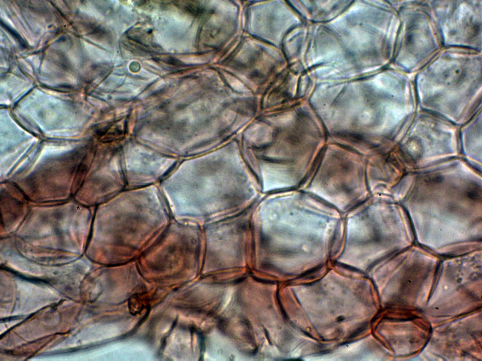Microscopía de Parasola plicatilis - 10 - Suprapellis 2